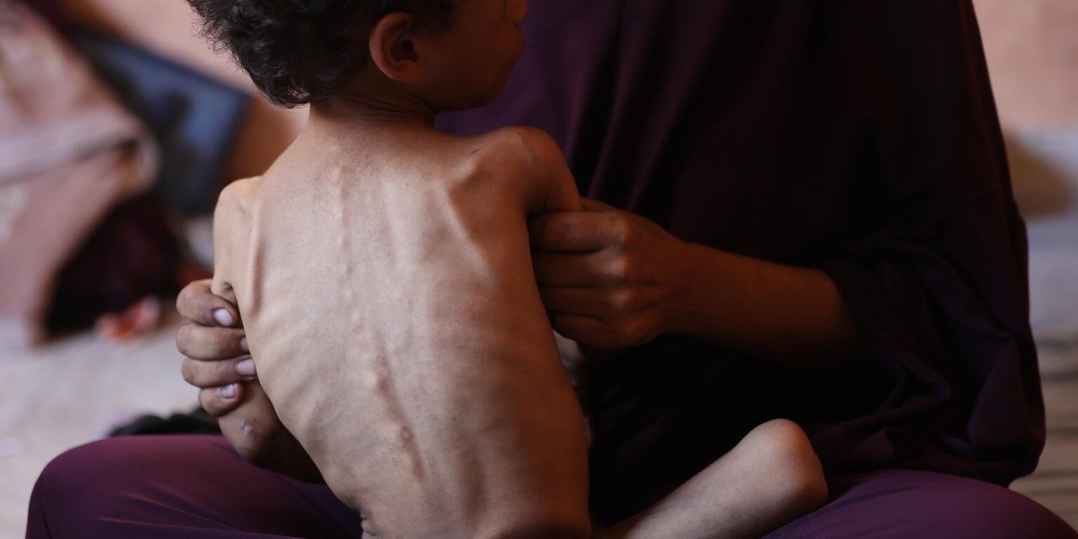 Agencje ONZ ostrzegają: Strefa Gazy stoi w obliczu klęski głodu