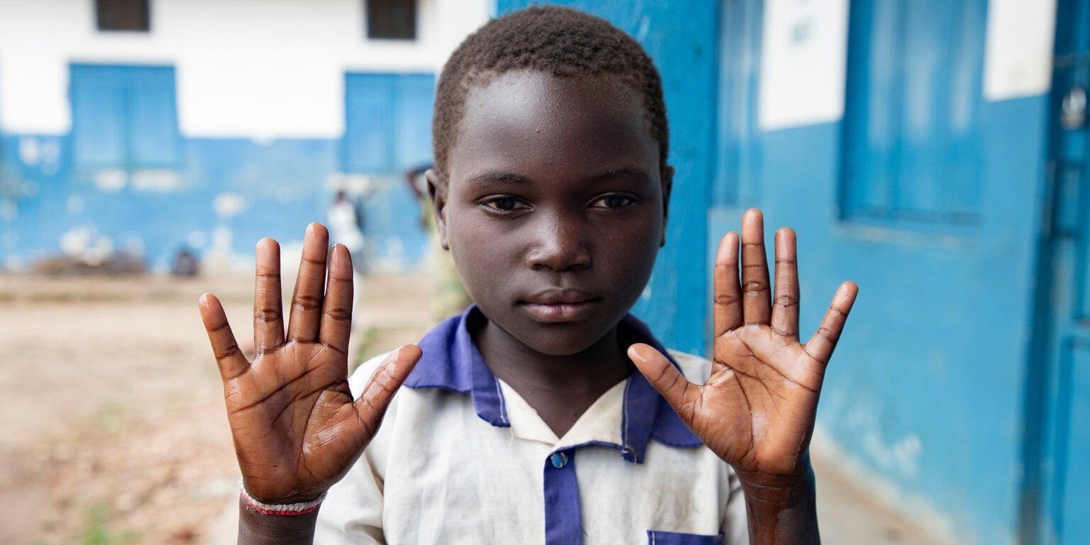 Wybuch epidemii wirusa Ebola w Demokratycznej Republice Konga i Ugandzie. Dzieci są w poważnym niebezpieczeństwie.
