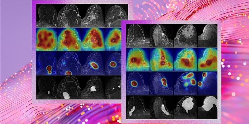 Tecnologia ao serviço da saúde: uma nova abordagem ao rastreio do cancro da mama