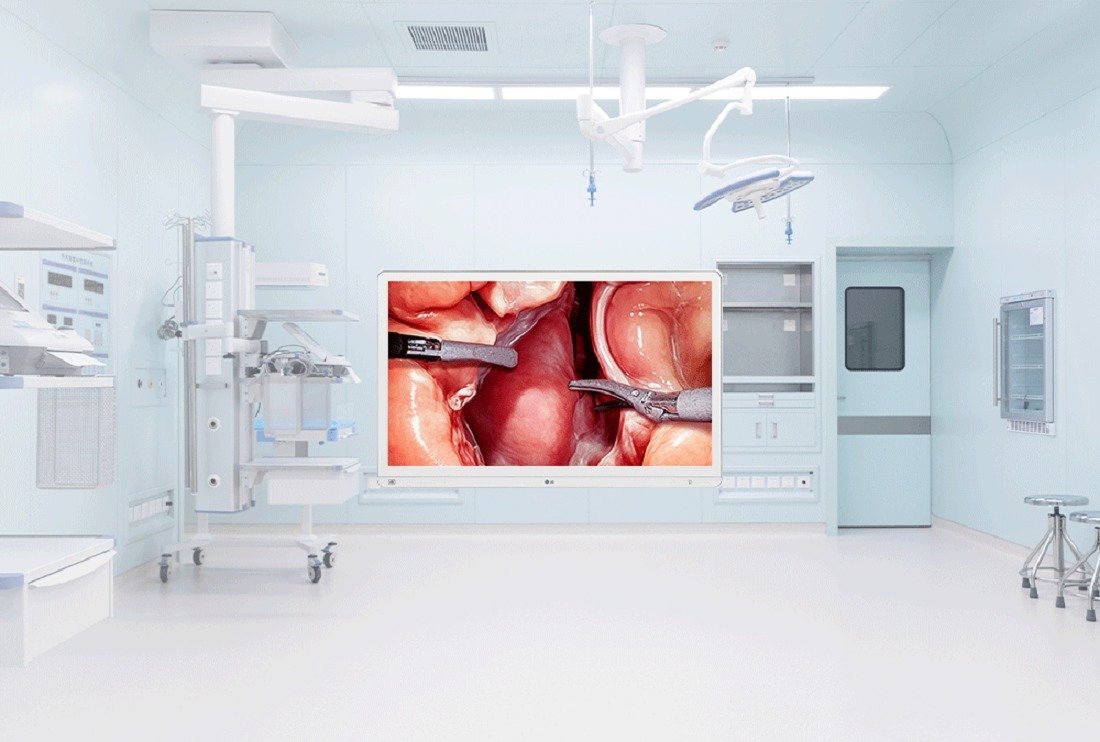 LG wprowadza monitor chirurgiczny 4K z funkcjami wspierającymi pracę zespołów operacyjnych