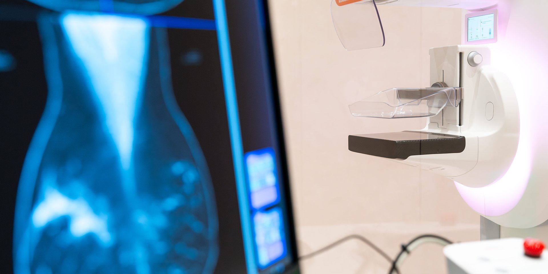 Clínica Mulher apresenta em Portugal sistema avançado de mamografia com inteligência artificial e resultados mais rápidos