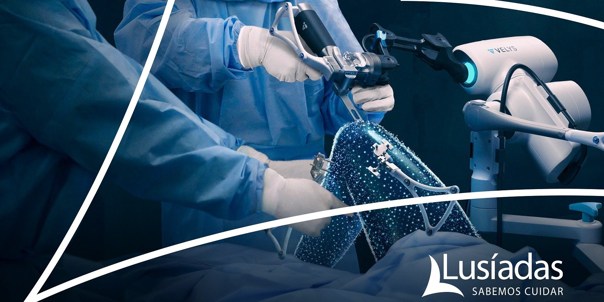 Grupo Lusíadas Saúde inicia cirurgia robótica do joelho no Hospital Lusíadas Amadora com o Sistema VELYS™