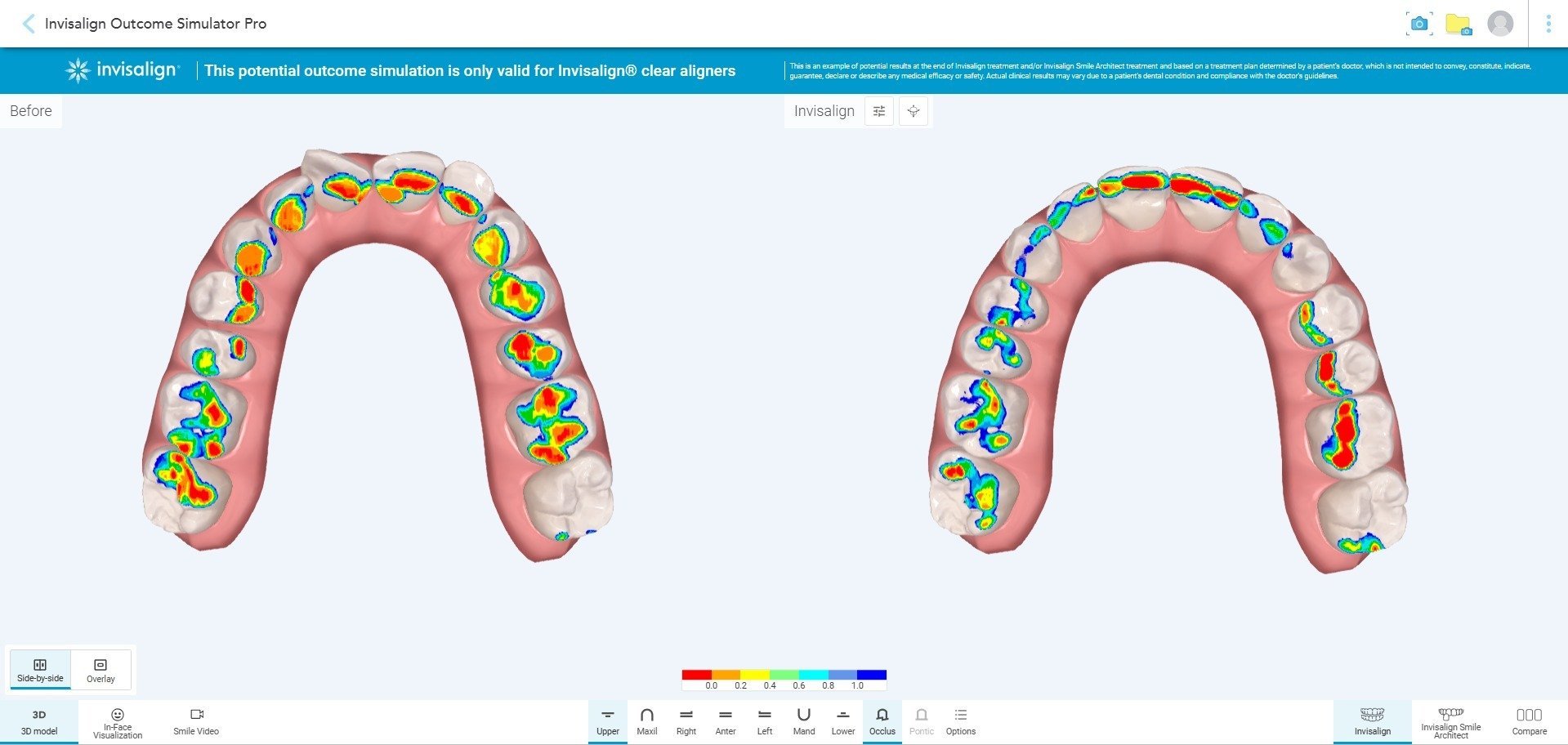 Align Technology presenta nuove soluzioni per migliorare il dialogo con i pazienti, favorire l’accettazione dei trattamenti e aumentare l’efficienza degli studi dentistici.