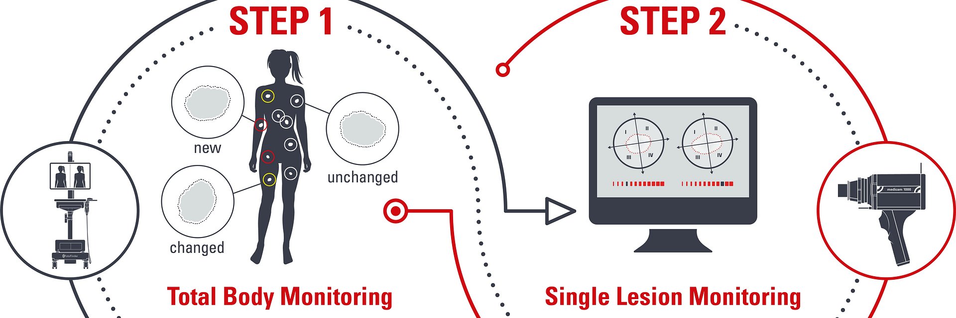 Sztuczna inteligencja wspiera leczenie raka skóry